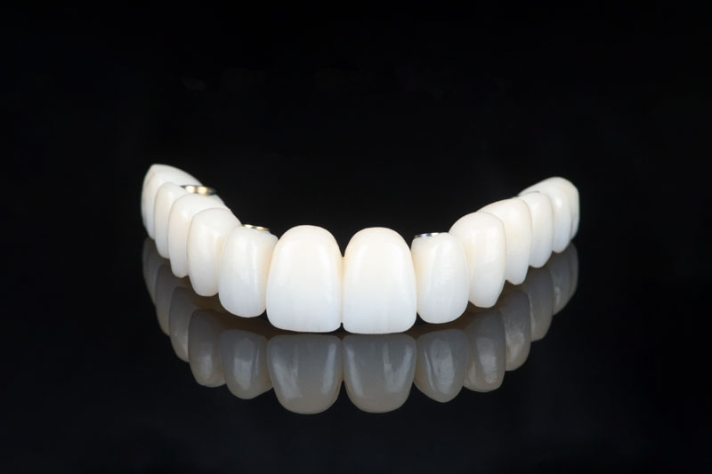 Cirurgia de Implantes Dentários